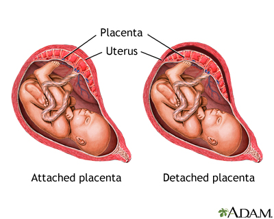 uterine placenta