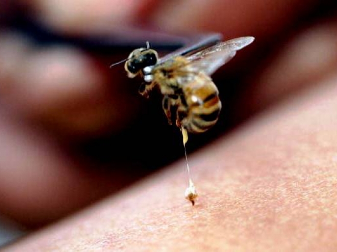 How to treat a bee sting?