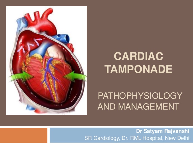 CARDIAC TAMPONADE PATHOPHYSIOLOGY AND MANAGEMENT Dr Satyam Rajvanshi SR  Cardiology, Dr. RML Hospital,