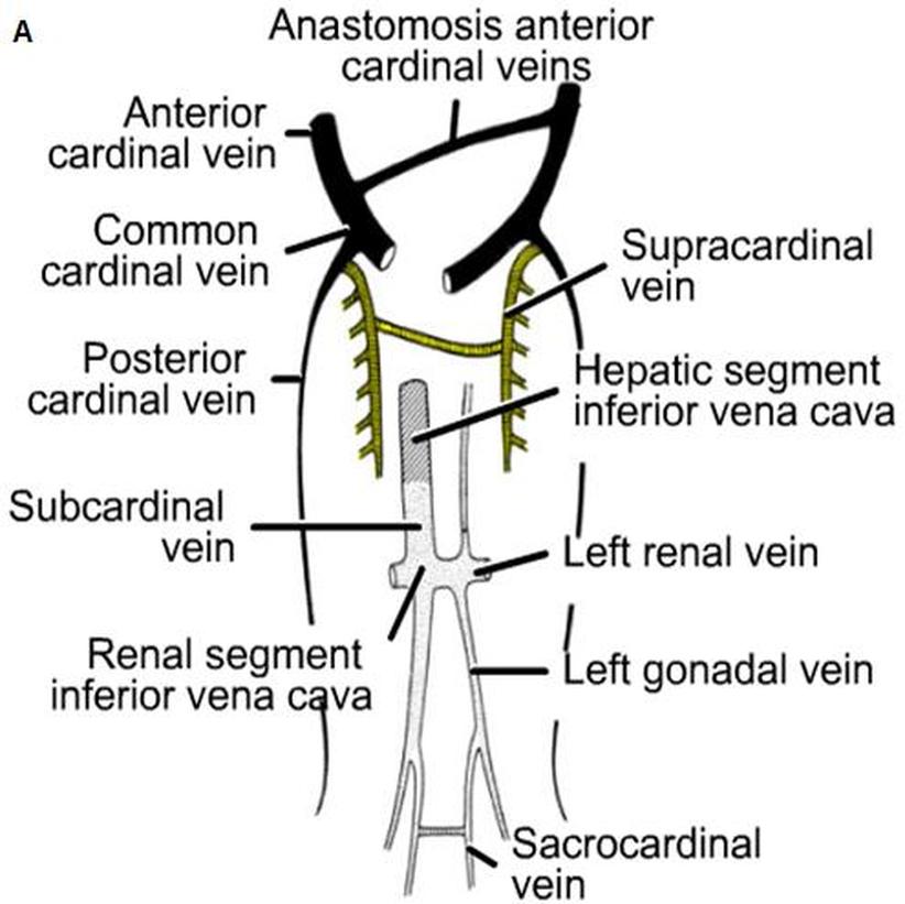 A: cardinal vein (7th week). B: cardinal vein at birth. C: vitelline and  umbilical veins (4th week). D: 5th week. E: 2nd month. F: 3rd month.