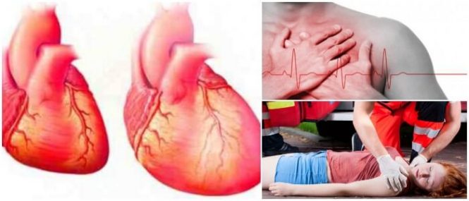 causas de la cardiomegalia