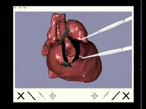 Virtual cardiotomy for preoperative planning