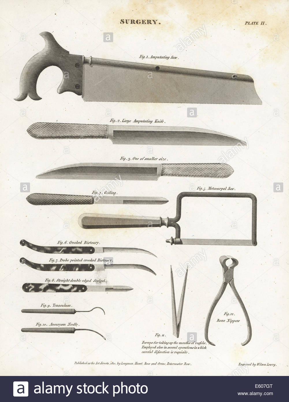 Equipo quirúrgico incluyendo amputar de sierras, cuchillos, catling,  bisturí, etc. Imagen