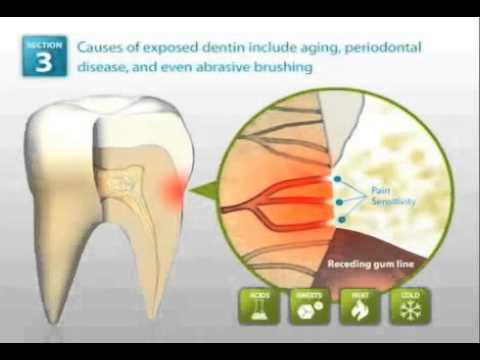Demineralized Tooth Enamel: Dynamics of Treatment