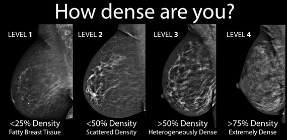breast density mammogram