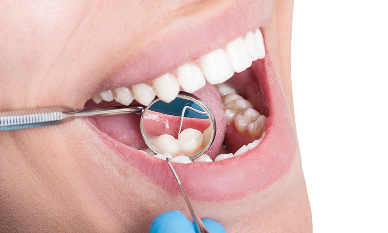 Pre-Dental Hygiene Emphasis