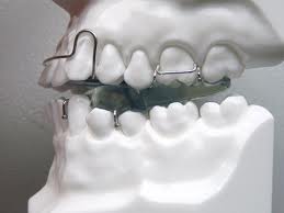 dental orthopedic appliance