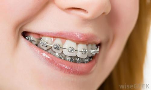 Orthodontics And Dentofacial Orthopedics