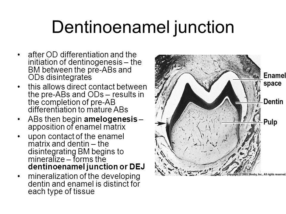 Dentinoenamel junction