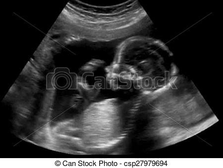 Obstetric Ultrasonography Ultrasound Echography of a first months fetus -  csp27979694