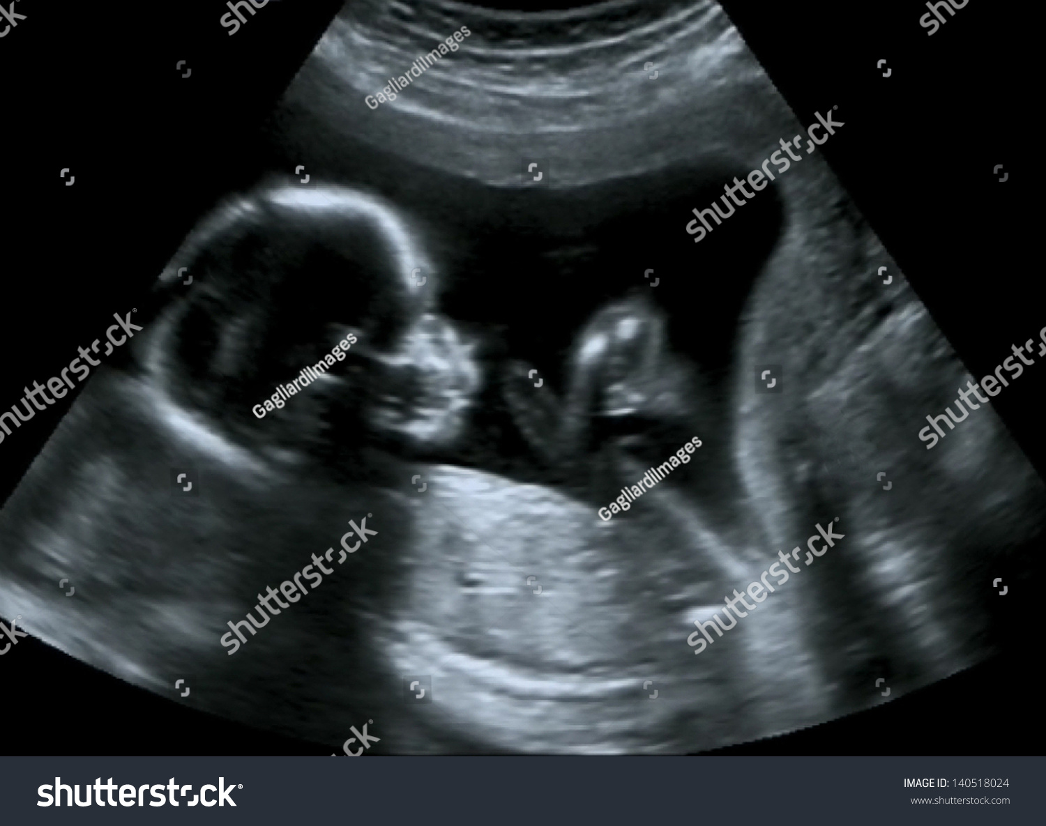 Obstetric Ultrasound of fetus at fourth month. Echography Scan.