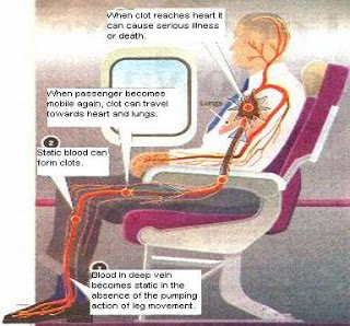 For the past several years, Economy class syndrome has been all over the  newspaper and TV headlines. In the economy class section of the aircraft,
