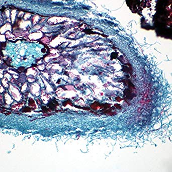 Ectotrophic Mycorrhiza, c.s, 12 m Microscope Slide