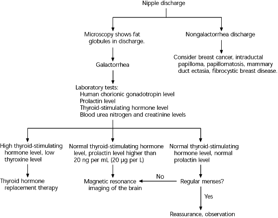 Evaluation of Galactorrhea