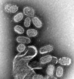 EM of influenza virus