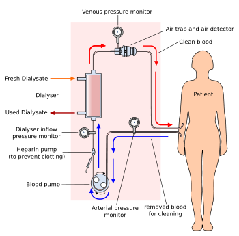 The haemodialysis blood circuit