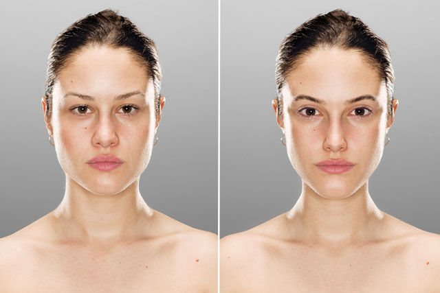Idealized Facial Comparisons
