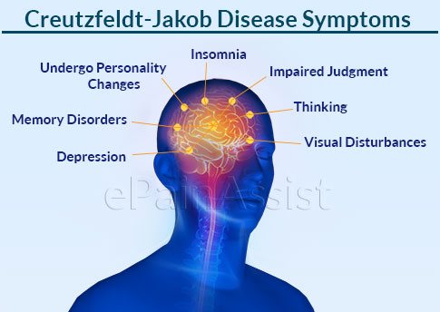 Creutzfeldt-Jakob Disease Symptoms