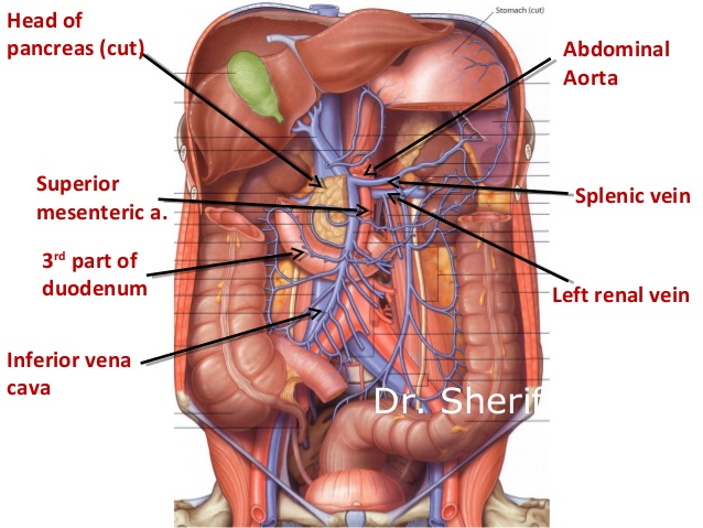 17. Abdominal Aorta Splenic vein