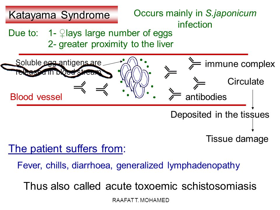 17 The patient suffers from: Katayama Syndrome