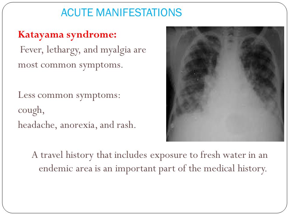 ACUTE MANIFESTATIONS Katayama syndrome: most common symptoms.