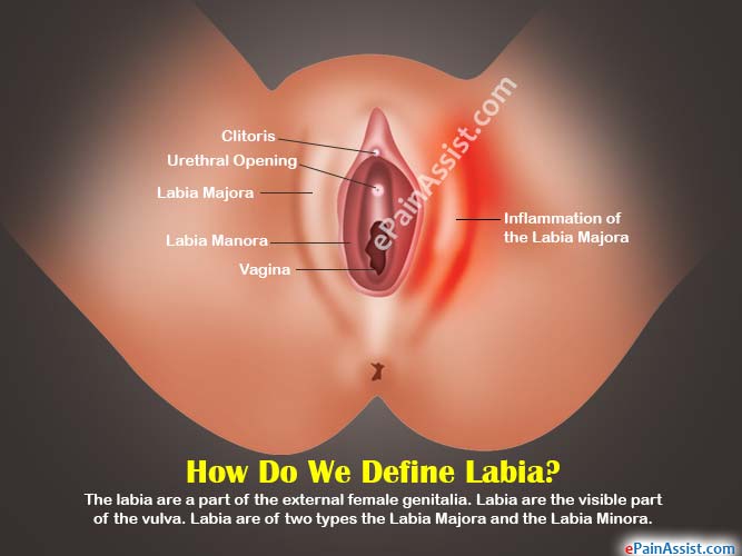How Do We Define Labia